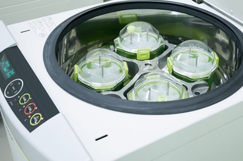 PRP(多血小板血漿)療法